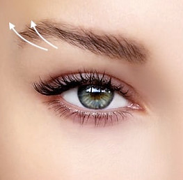 Brow Lift